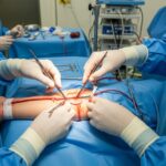 Vascular Surgery