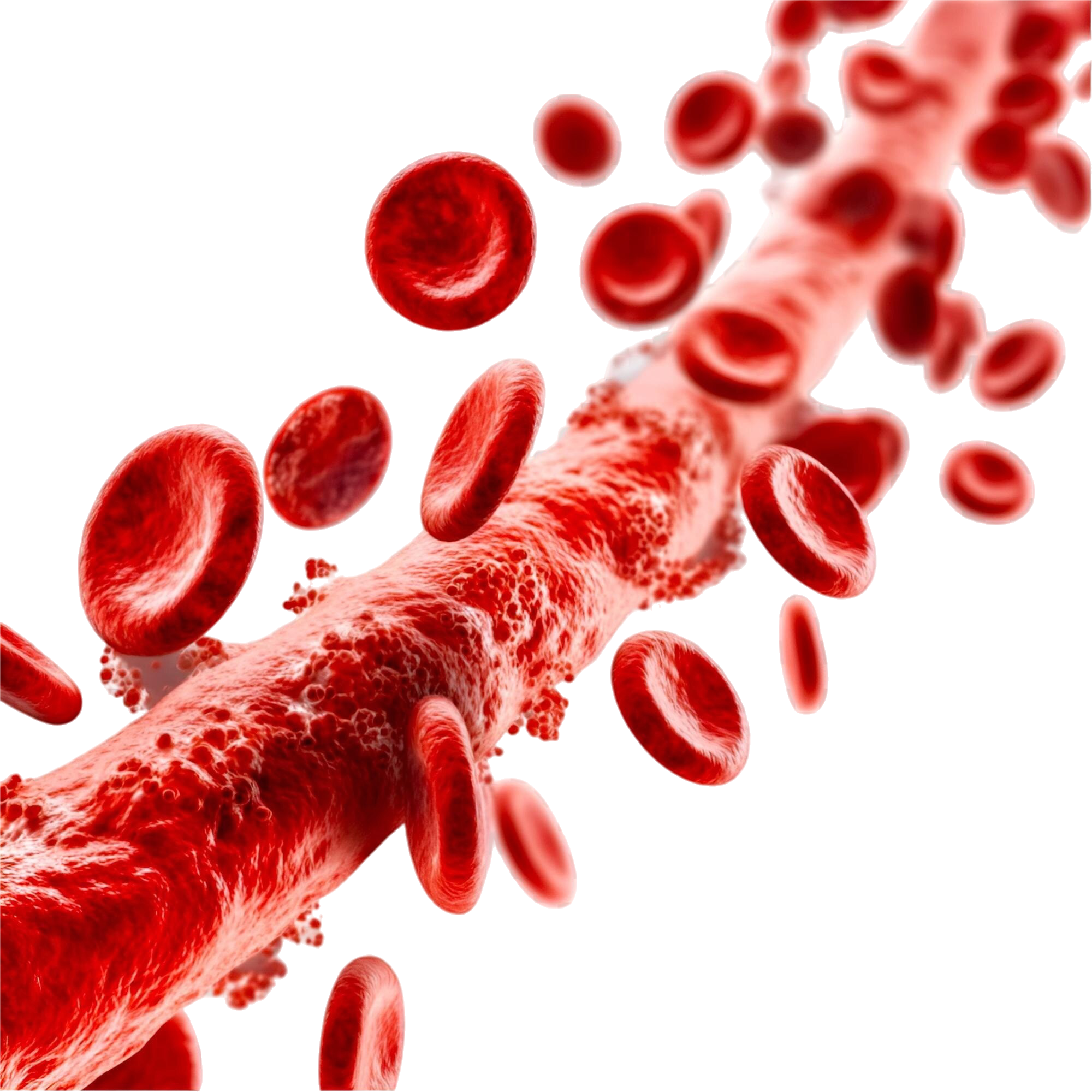 Chronic Limb-Threatening Ischemia