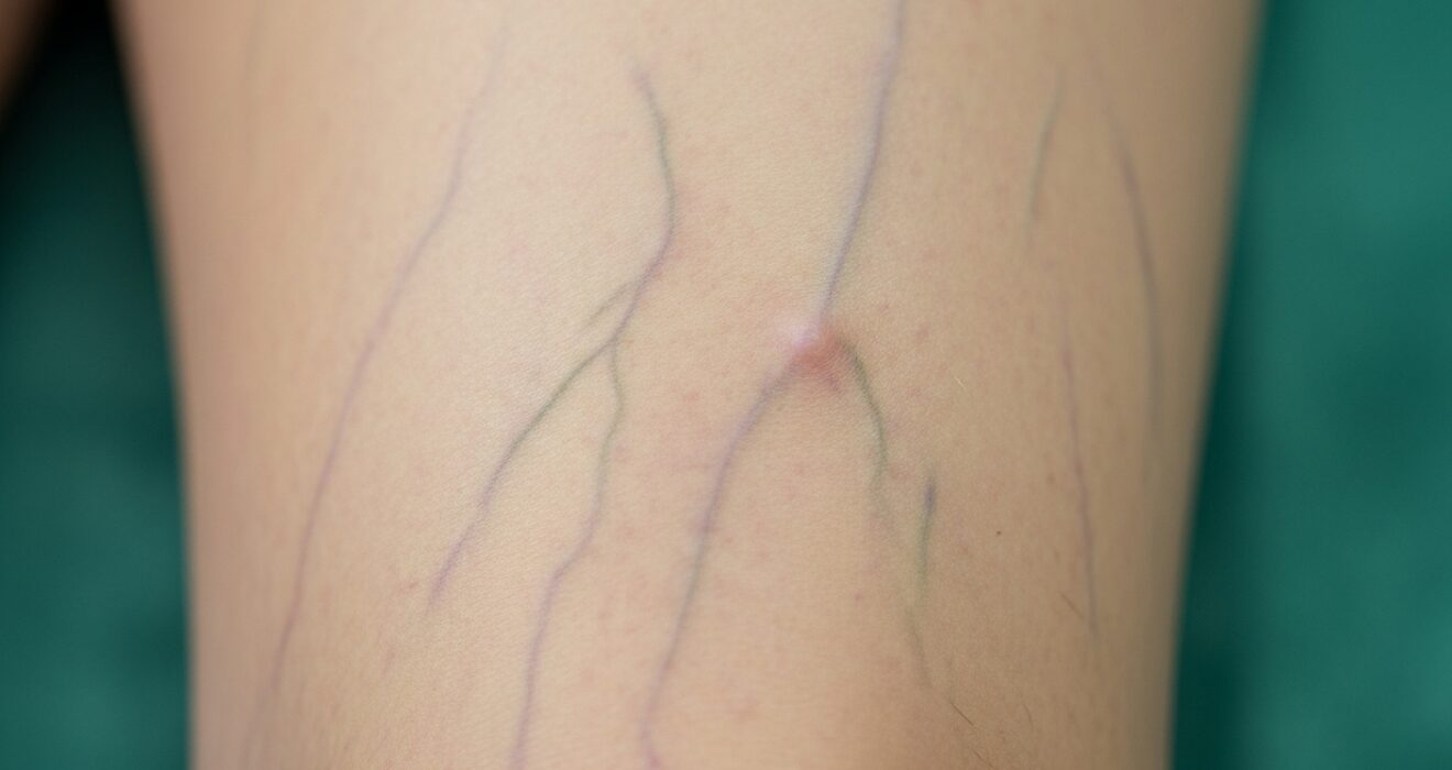 Vascular Meaning in Urdu