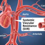 Systemic Vascular Resistance