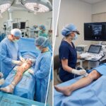 Surgery for Varicose Veins